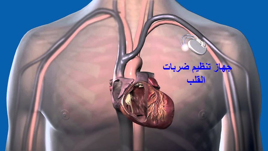 تنظيم ضربات القلب الطبيعي