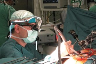 تغيير الصمام الميترالي