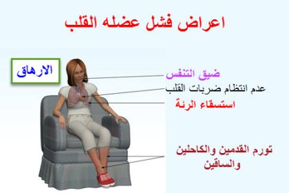 اعراض فشل عضلة القلب