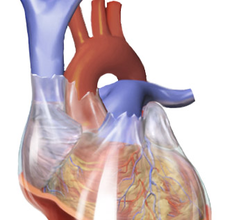 تجمع السوائل حول القلب داخل غشاء التامور