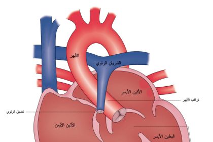 رباعية فالوت