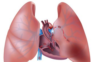 الجلطة الرئوية