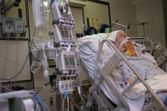 خطورة عملية القلب المفتوح