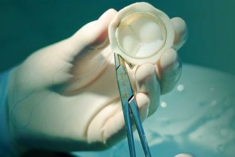 أفضل أنواع صمامات القلب