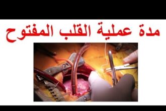 مدة عملية القلب المفتوح